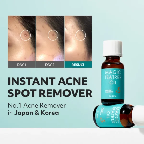 Tea Tree Oil (heal pimples/acne)